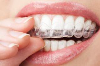 Centrum Grof Samenwerken met Thuisbehandelingen voor wittere tanden | LISTERINE®