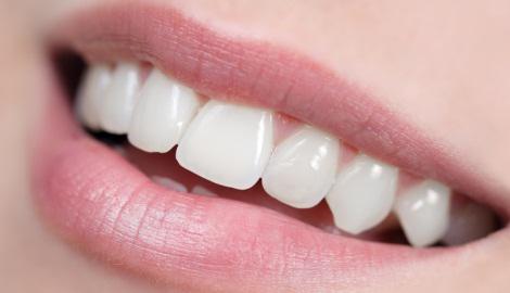 veld studio Amazon Jungle Thuisbehandelingen voor wittere tanden | LISTERINE®